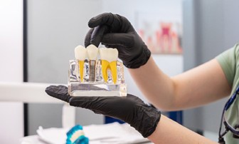 Dentist with gloved hands holding model of dental implant