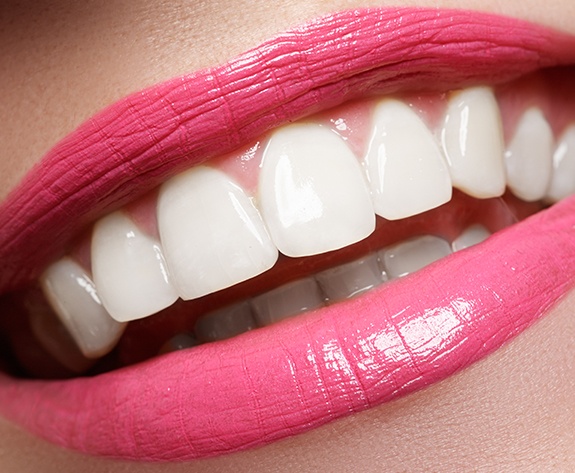 Closeup of flawless smile with metal free restorations