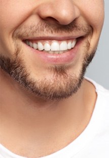 We can help you reveal your best smile yet near Lake Oconee