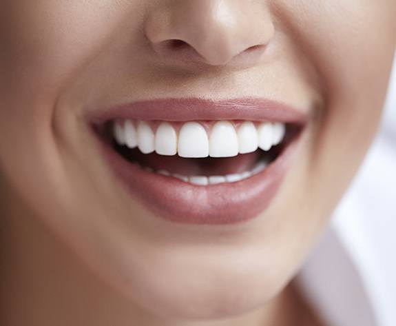 Closeup of smile after dental crown restoration