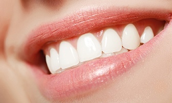a person smiling with bright veneers in Greensboro