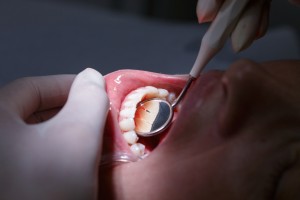 You don’t have to suffer from gum disease in Greensboro. 